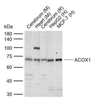 ACOX1 Rabbit Polyclonal Antibody