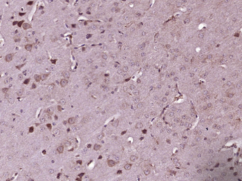 ACOX2 Rabbit Polyclonal Antibody