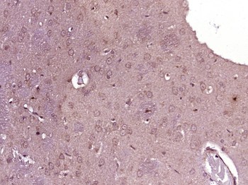 ACOX2 Rabbit Polyclonal Antibody