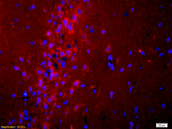 ADCY10 Rabbit Polyclonal Antibody