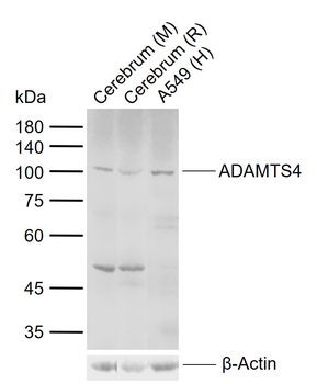 ADAMTS4 Rabbit Polyclonal Antibody