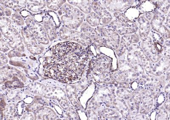 ITGAV Rabbit Polyclonal Antibody