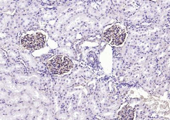 ITGAV Rabbit Polyclonal Antibody