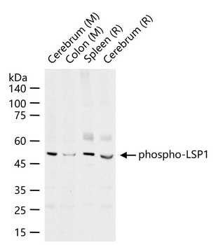 Phospho-LSP1 (Ser204) Rabbit Polyclonal Antibody