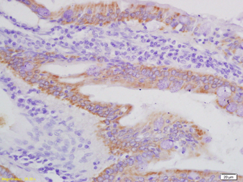 AXL Rabbit Polyclonal Antibody