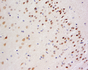 BACH1 Rabbit Polyclonal Antibody