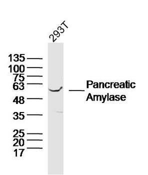 Pancreatic Amylase Rabbit Polyclonal Antibody