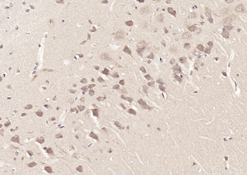 SRP68 Rabbit Polyclonal Antibody