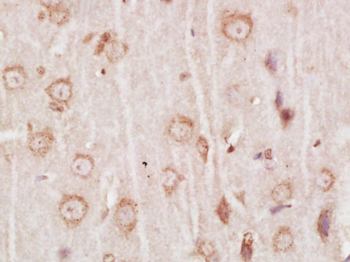 SYT6 Rabbit Polyclonal Antibody