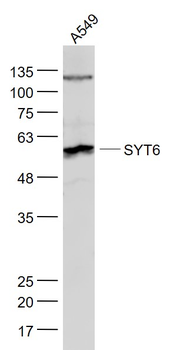 SYT6 Rabbit Polyclonal Antibody
