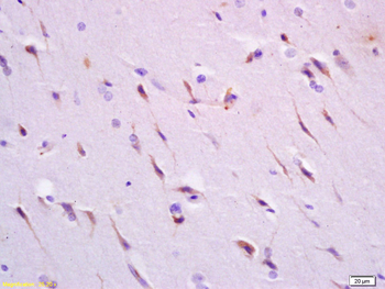 SYT6 Rabbit Polyclonal Antibody