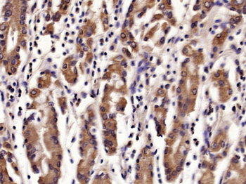 GOLPH2 Rabbit Polyclonal Antibody