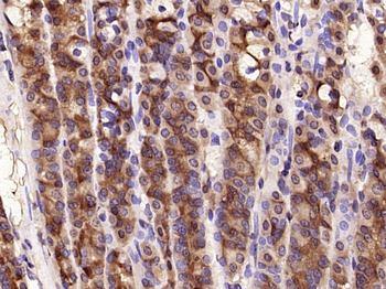 GOLPH2 Rabbit Polyclonal Antibody