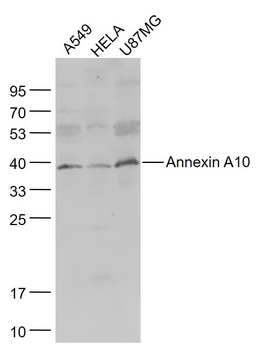 Annexin A10 Rabbit Polyclonal Antibody