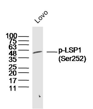 Phospho-LSP1 (Ser252) Rabbit Polyclonal Antibody