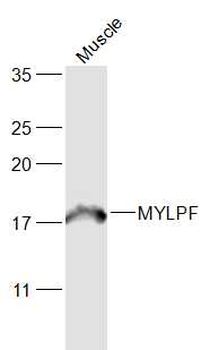 MYLPF Rabbit Polyclonal Antibody