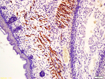 MYLPF Rabbit Polyclonal Antibody