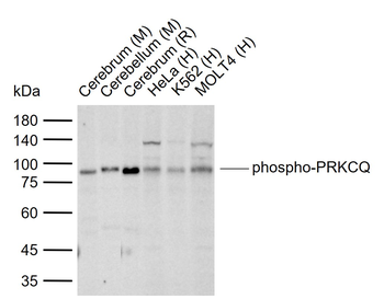 Phospho-PRKCQ (Thr538) Rabbit Polyclonal Antibody