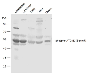 Phospho-ATG4D (Ser467) Rabbit Polyclonal Antibody