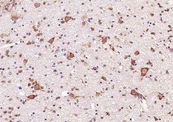 ABAT Rabbit Polyclonal Antibody