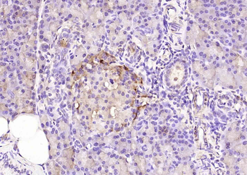 ABAT Rabbit Polyclonal Antibody