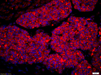 Amphiregulin Rabbit Polyclonal Antibody
