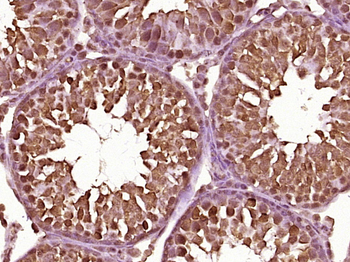 Phospho-AR/Androgen receptor (Ser650) Rabbit Polyclonal Antibody