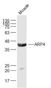 Angiopoietin-like 4 Rabbit Polyclonal Antibody