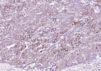 SGPL1 Rabbit Polyclonal Antibody
