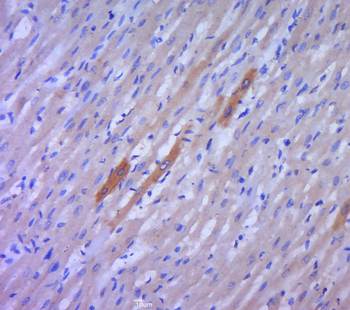 DDIT4 Rabbit Polyclonal Antibody