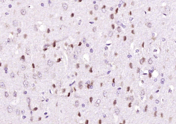TBL1X/SMAP55 Rabbit Polyclonal Antibody