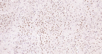 TBL1X/SMAP55 Rabbit Polyclonal Antibody