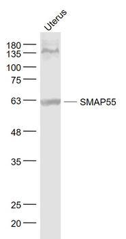 TBL1X/SMAP55 Rabbit Polyclonal Antibody