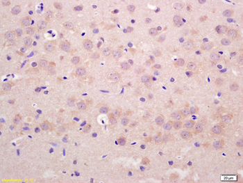 GIT1 Rabbit Polyclonal Antibody