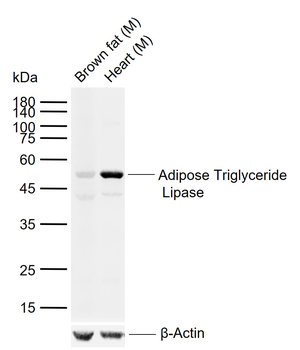 Adipose Triglyceride Lipase Rabbit Polyclonal Antibody