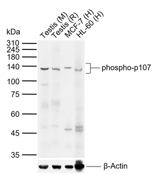 RBL1 (phospho-Ser975) antibody