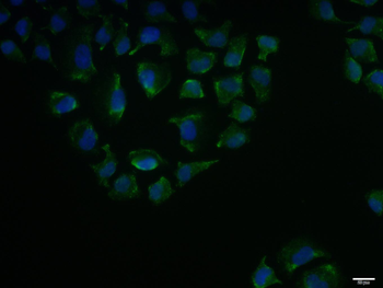 VLDL Receptor Rabbit Polyclonal Antibody