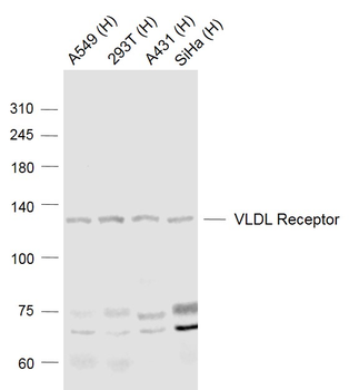 VLDL Receptor Rabbit Polyclonal Antibody