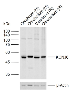KCNJ6 Rabbit Polyclonal Antibody