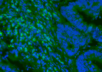 IFIT1 Rabbit Polyclonal Antibody (FITC)