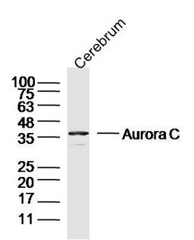 Aurora C Rabbit Polyclonal Antibody