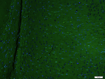 SLC25A38 Rabbit Polyclonal Antibody (FITC)