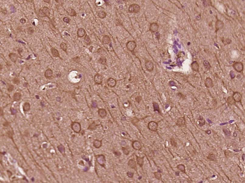 Phospho-BCL10 (Ser218) Rabbit Polyclonal Antibody