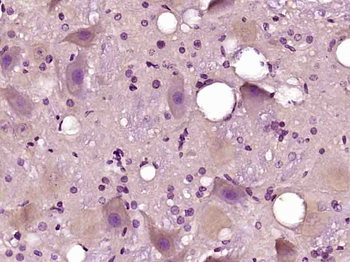 Thioredoxin 2 Rabbit Polyclonal Antibody