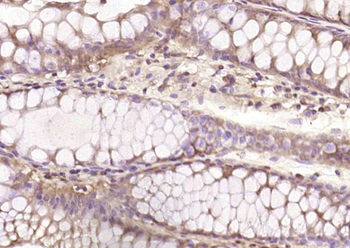 Phospho-Bcl-2 (Ser70) Rabbit Polyclonal Antibody