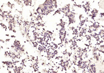 Phospho-Bcl-2 (Ser70) Rabbit Polyclonal Antibody