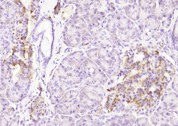 Phospho-Bcl-2 (Ser70) Rabbit Polyclonal Antibody