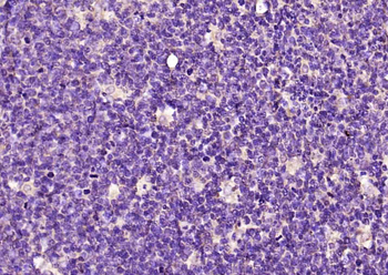 Phospho-Bcl-2 (Ser70) Rabbit Polyclonal Antibody