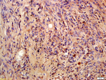 Phospho-BLNK (Tyr96) Rabbit Polyclonal Antibody