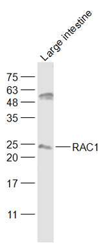 RAC1 Rabbit Polyclonal Antibody